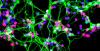 Neurons growing in a culture dish (NASA)