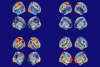 1200-brain-activation-subtypes.png