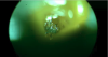 single maggot can eat twice eats body weight in one day