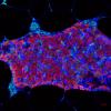 Transplanted pancreatic islet cells