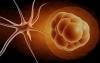 Stem cell and neuron