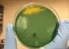 Cholera on Agar Plate