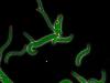 E. coli cells under stress