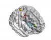 Brain temporary magnetic stimulation areas
