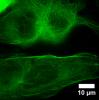 Microtubular structure