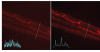 Left: Noisy images showing neuronal structures. Right: NIDDL Deep Denoised image of neuronal structures.