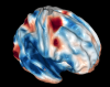 FMRI brain image frontal cortex vision