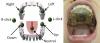 Intraoral Tongue Drive System commands