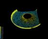 Toroidal structure observed with confocal microscope